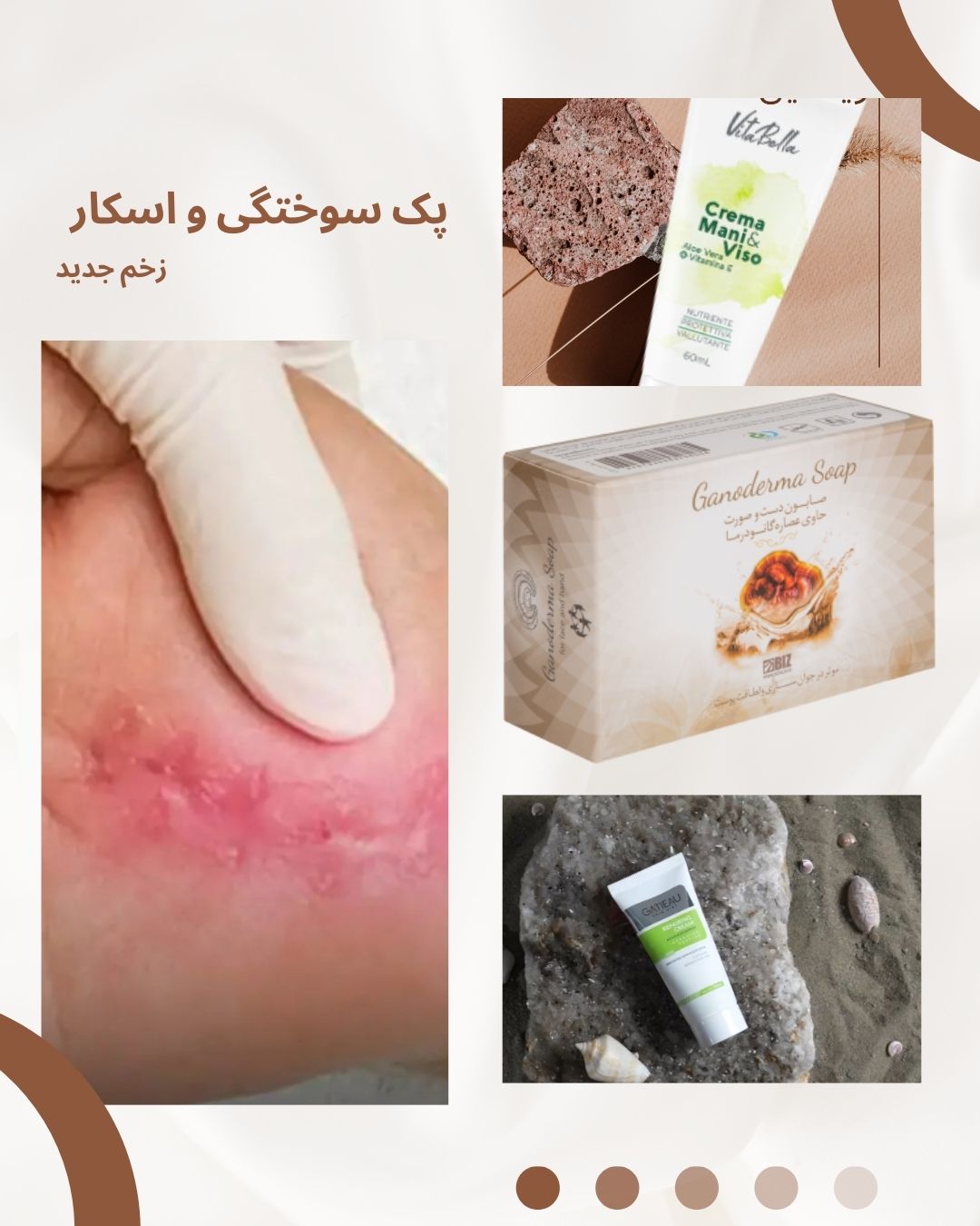 پک اسکار و جای زخم جدید